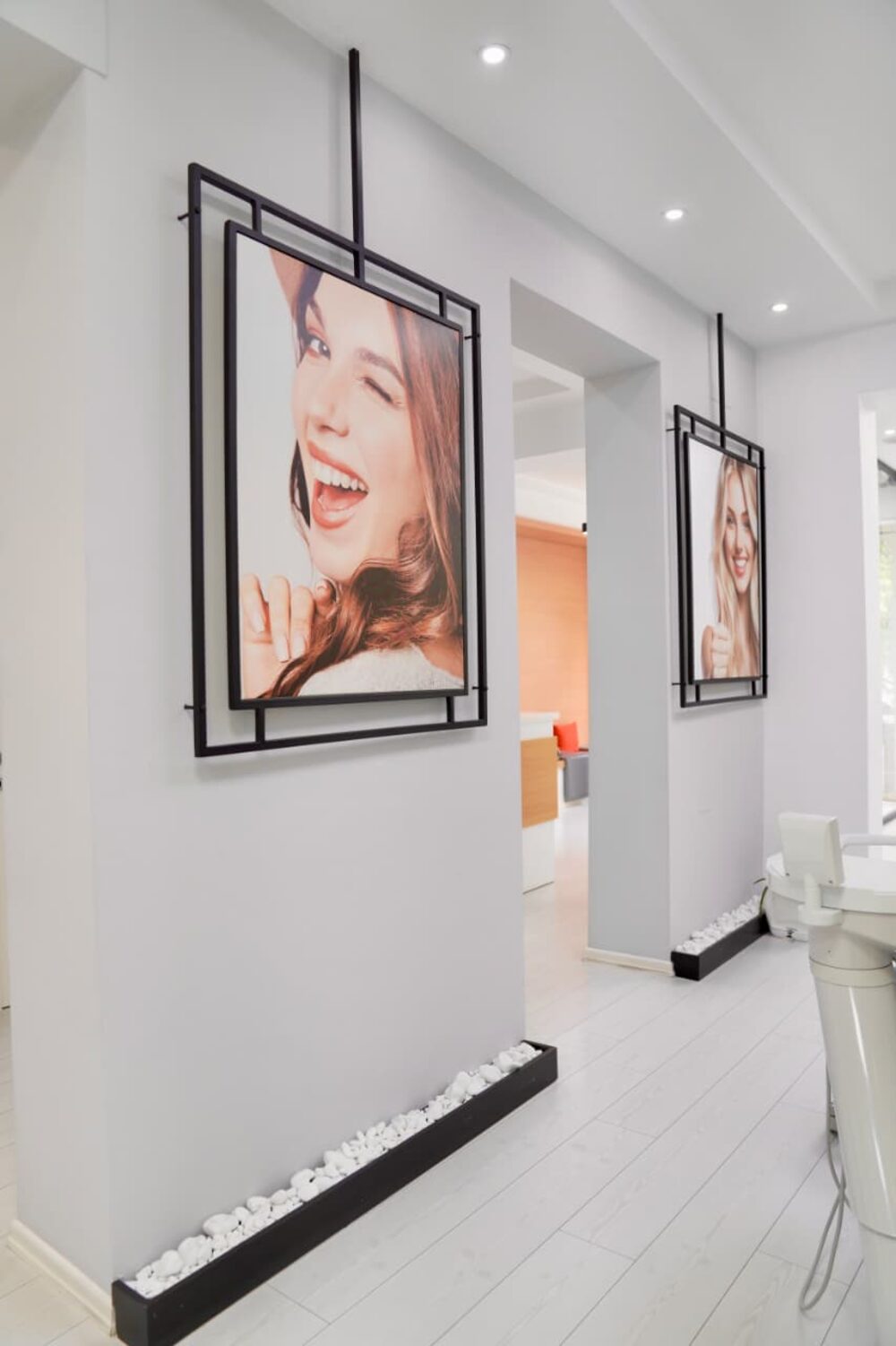 Vorher-Nachher Ergebnis Perfect Dental Center